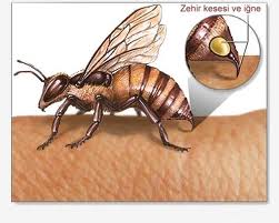 Arı Akrep Böcek Sokmalarında ne Yapılmalı